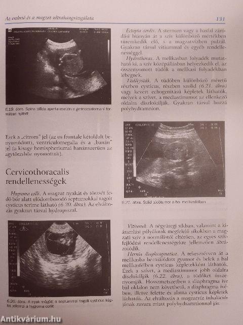 Az intrauterin magzat