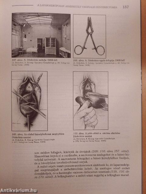 Nőgyógyászati laparoszkópos sebészet