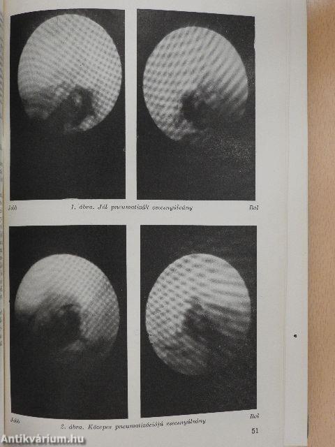 Fül-orr-gégegyógyászat 1963-1964. január-december