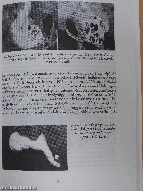 A honfoglaló és Árpád-kori magyarság egészsége és betegségei