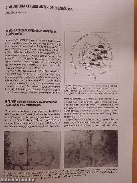 Vascularis neurologia