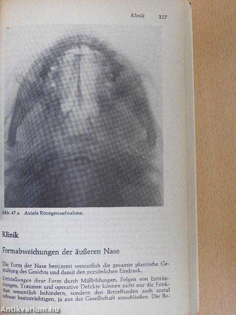 Hals-Nasen-Ohren-Heilkunde