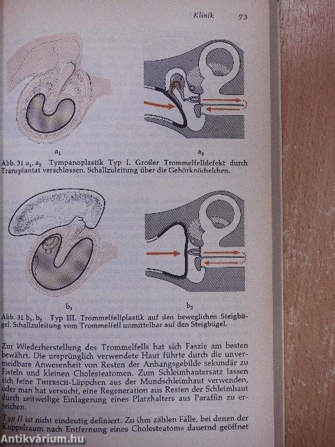 Hals-Nasen-Ohren-Heilkunde