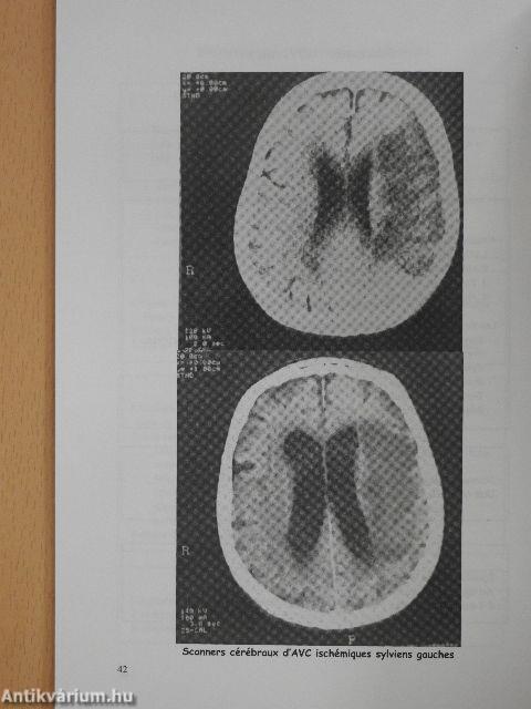 Neurologie