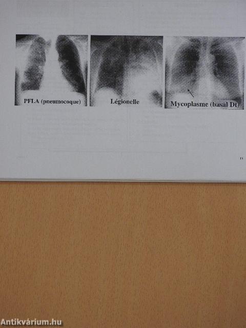 Pneumologie