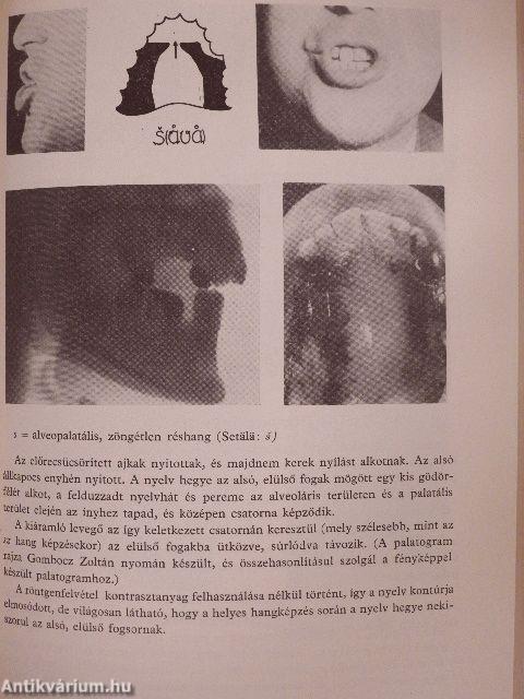 Helyes kiejtés, szép magyar beszéd