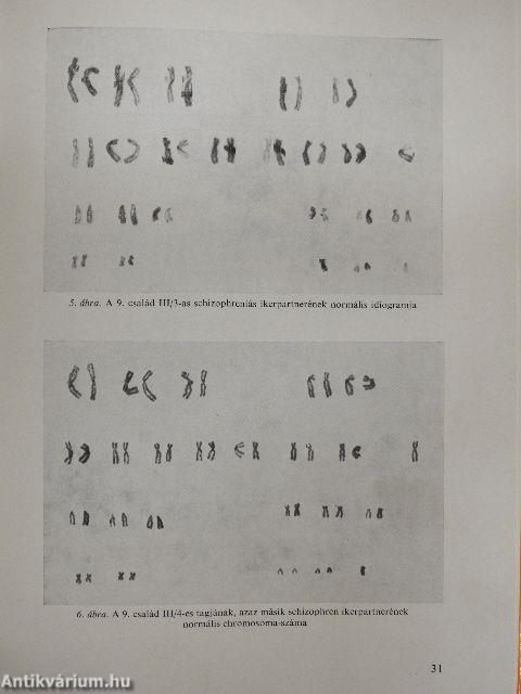 A nemi chromosoma-aberrációk idegrendszeri vonatkozásai