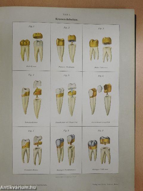 Atlas und Lehrbuch meiner Systeme der modernen Zahnärztlichen Metalltechnik