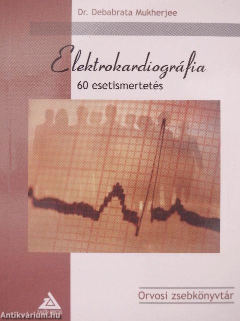 Elektrokardiográfia - 60 esetismertetés