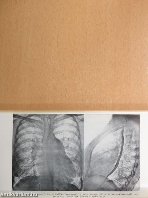 Cardiologia az orvosi gyakorlatban