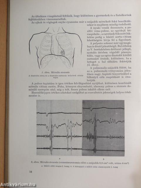 Operálható szívbetegségek