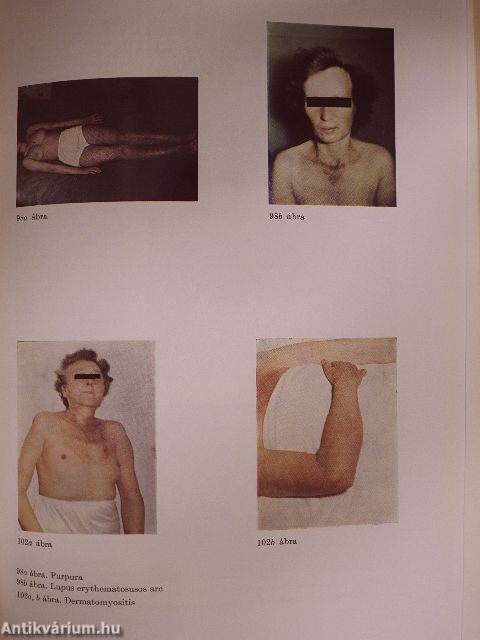 Gyakorlati belgyógyászat