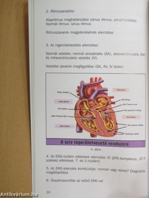 EKG alapismeretek