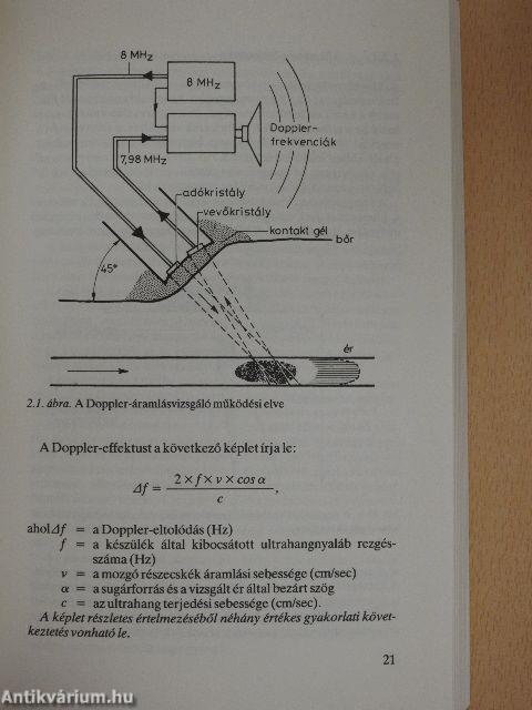 Angiológiai Doppler-diagnosztika