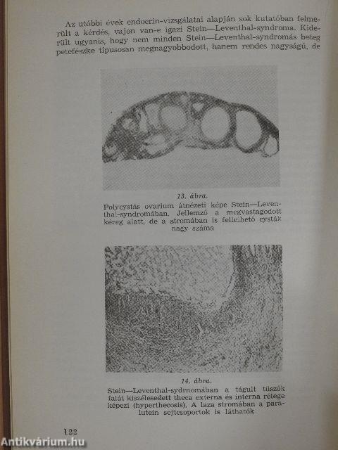 A gyakorló orvos nőgyógyászati endocrinologiája