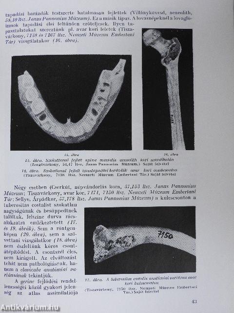 Palaeopathologia II.