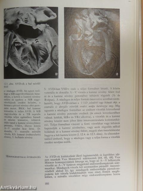 A veleszületett szívbetegségek klinikopatológiája