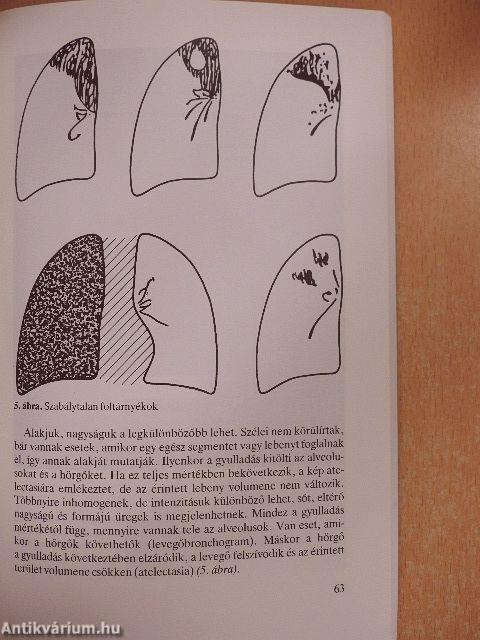 A tüdőbetegségek diagnózisa