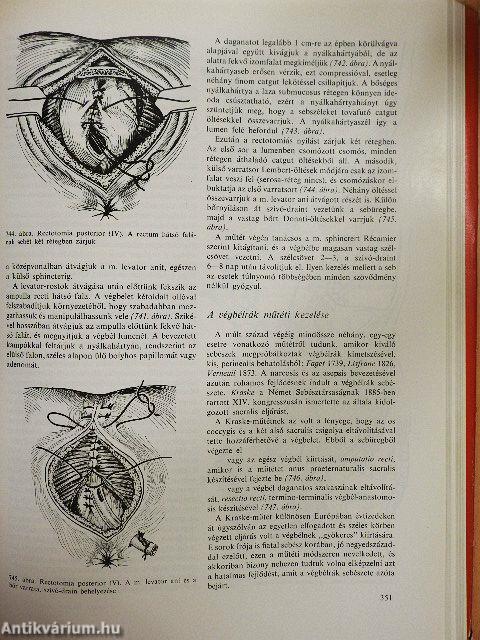 Sebészeti műtéttan