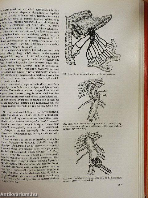 Sebészeti műtéttan