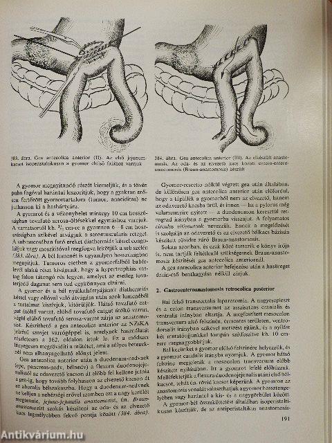 Sebészeti műtéttan