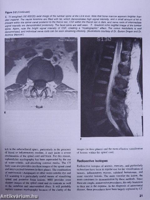 Principles of Neurology