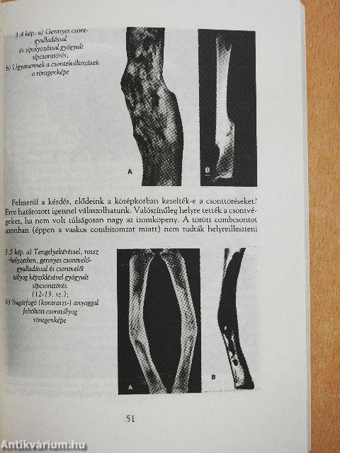 A honfoglaló és Árpád-kori magyarság egészsége és betegségei