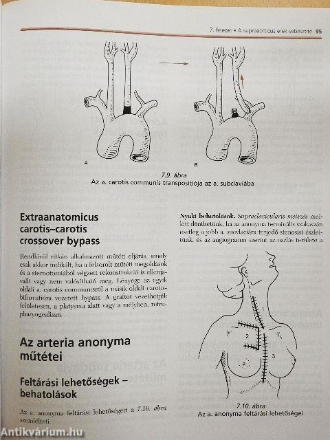 Az érsebészet tankönyve