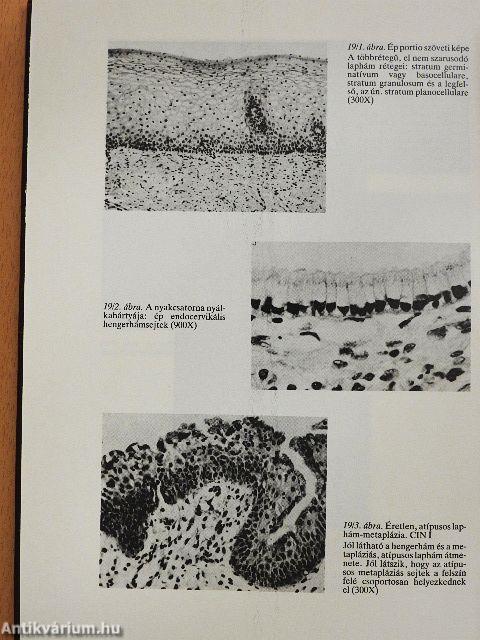 A szülészet és nőgyógyászat időszerű kérdései
