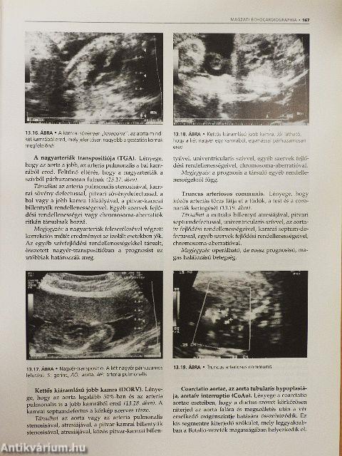 Szülészet-nőgyógyászati ultrahang-diagnosztika