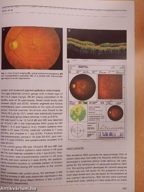 European Journal of Ophthalmology July-August 2008