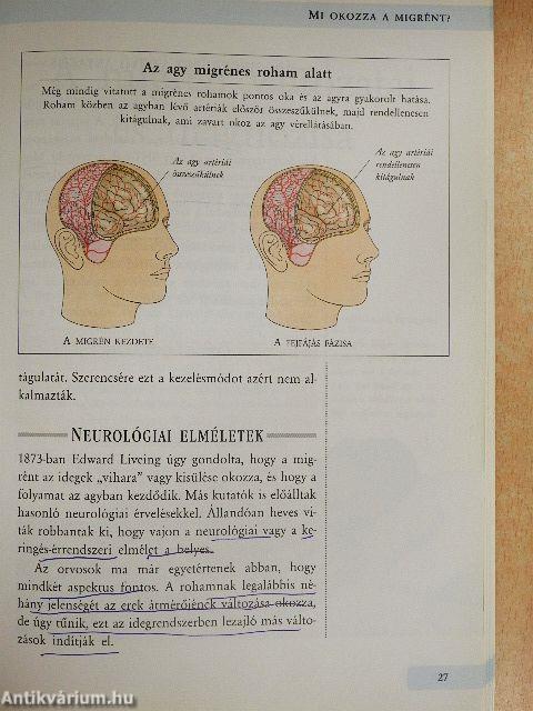 A migrén és egyéb fejfájások