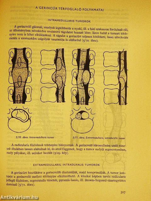 Klinikai röntgendiagnosztika