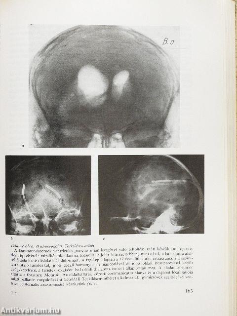 A klinikai neurologia alapjai