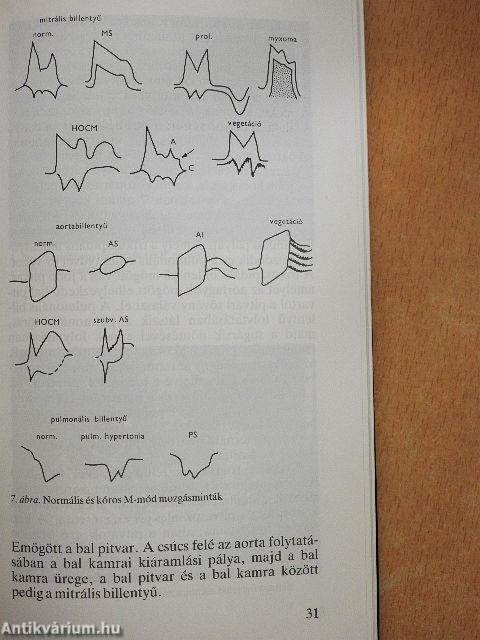 Echokardiográfia