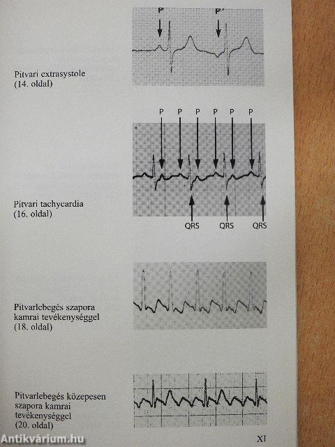 EKG a sürgősségi ellátásban