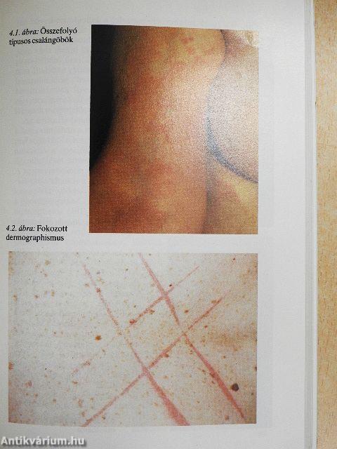 Gyakorlati allergológia