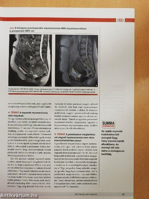 OBG Management válogatás 2017. március-november