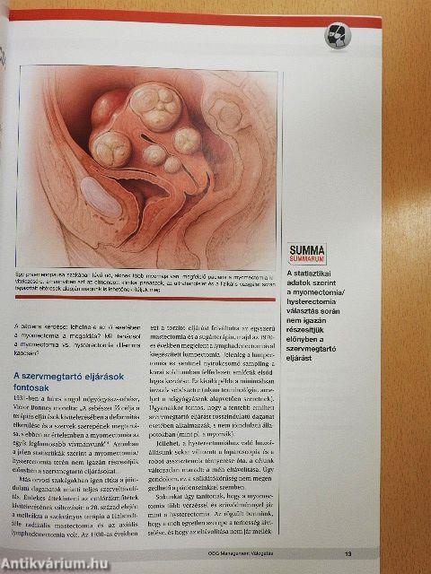 OBG Management válogatás 2017. március-november
