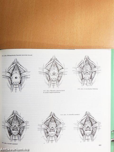 Szülészeti-nőgyógyászati műtéttan 2. (töredék)