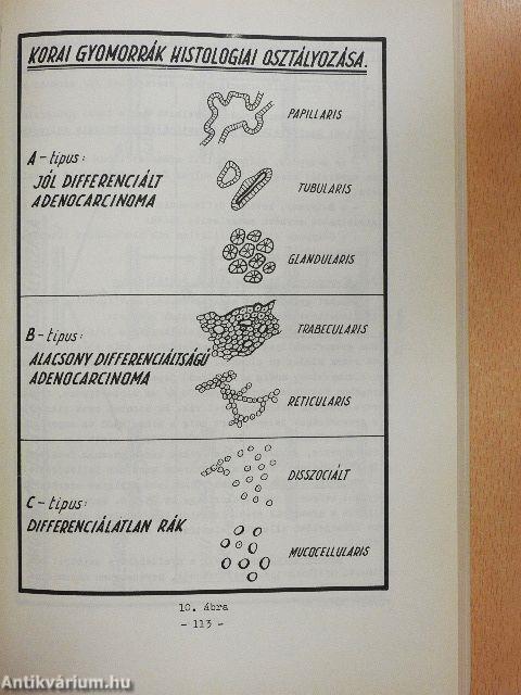 A daganatok cytologiai diagnosztikája II.