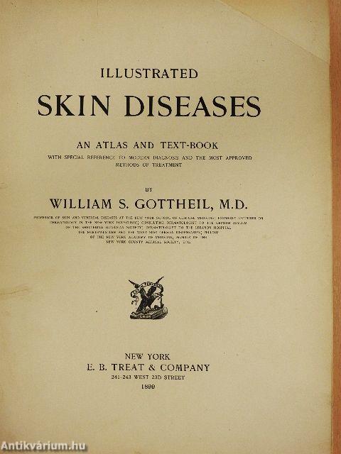 Illustrated skin diseases