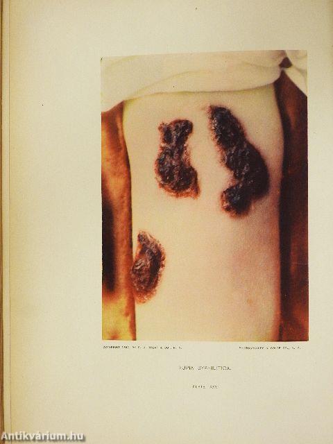 Illustrated skin diseases