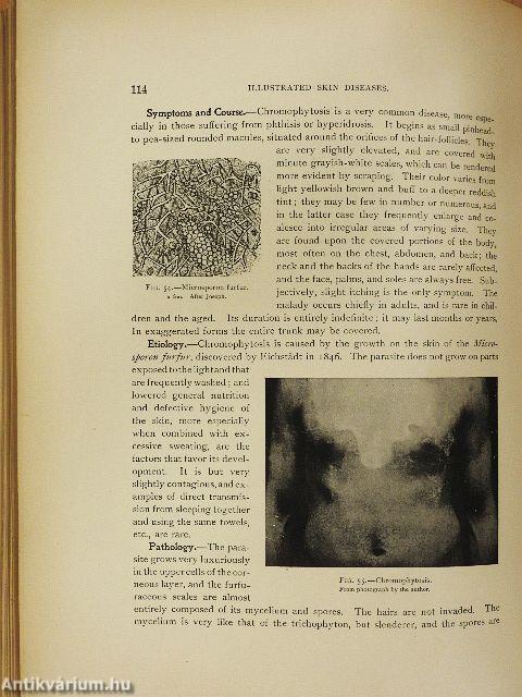 Illustrated skin diseases