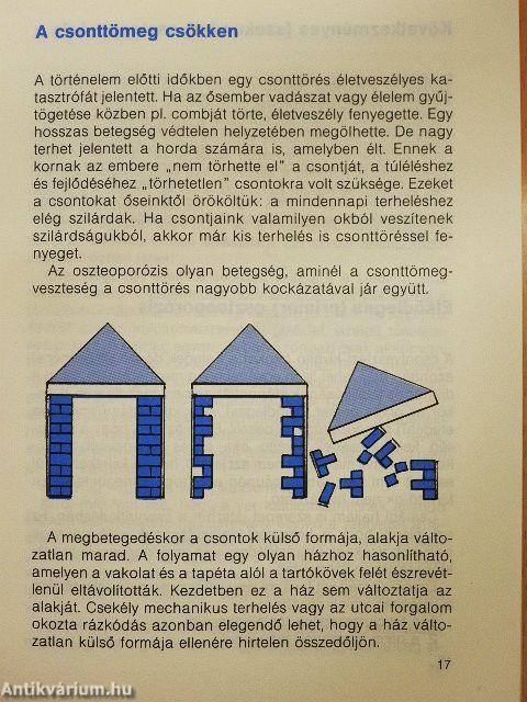 Mit kell tudni a csontritkulásról?