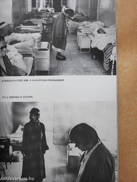 Téboly/Terápia/Stigma
