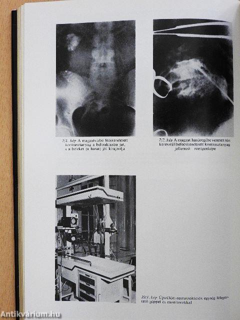 Intenzív szülőszoba