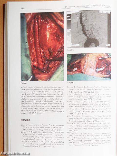 Vascularis neurologia