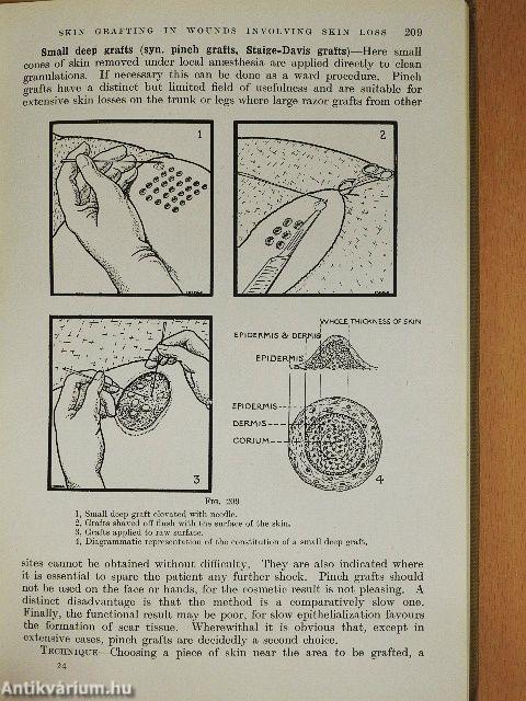Surgery of Modern Warfare II. (töredék)