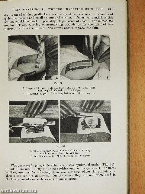 Surgery of Modern Warfare II. (töredék)